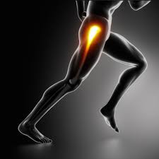 Trochanteric Bursitis Treatment