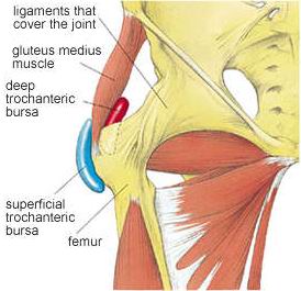 Trochanteric Bursitis Treatment
